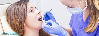 5 Stages of Cavities and How They Progress